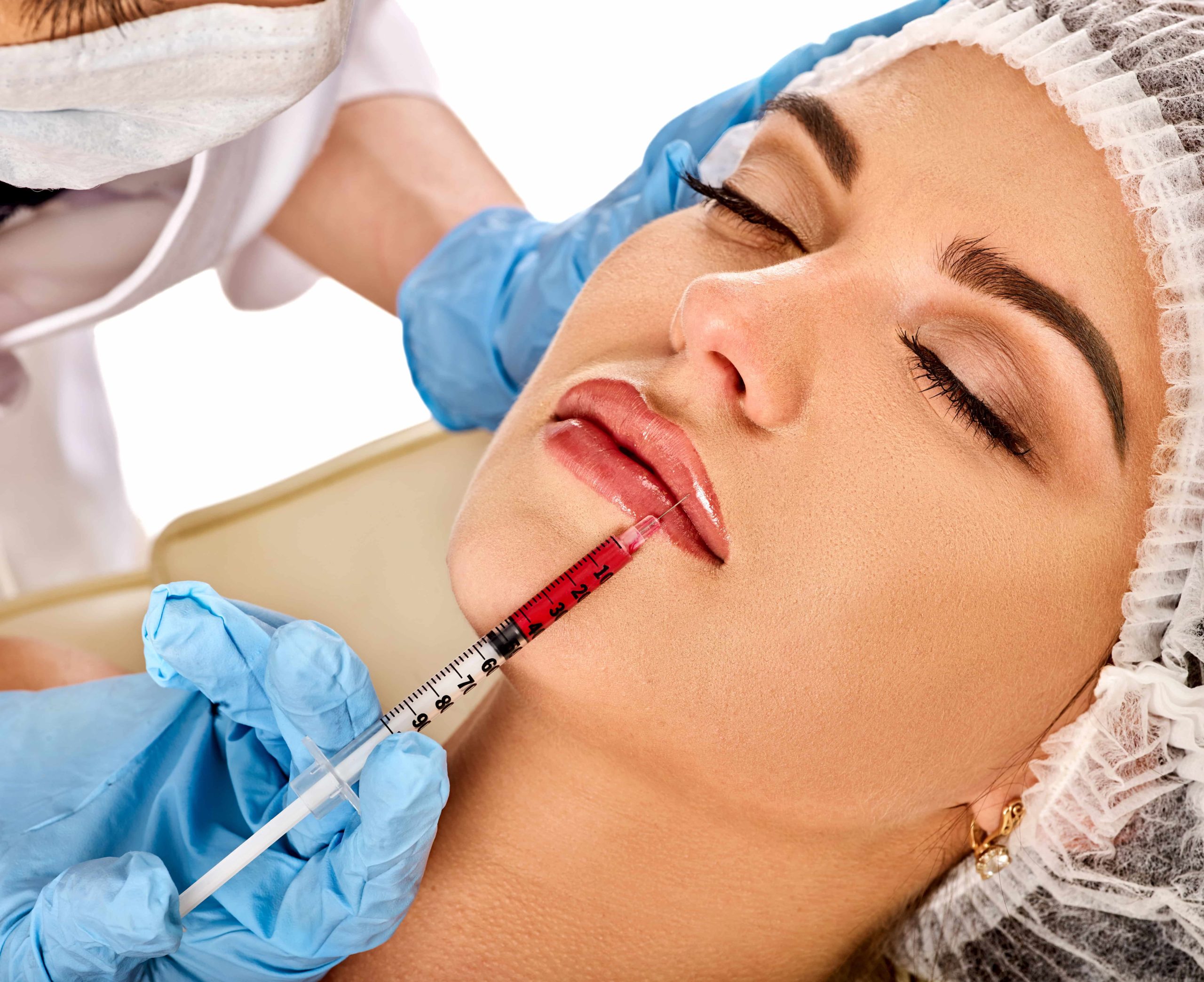 Which is better Juvederm or Restylane