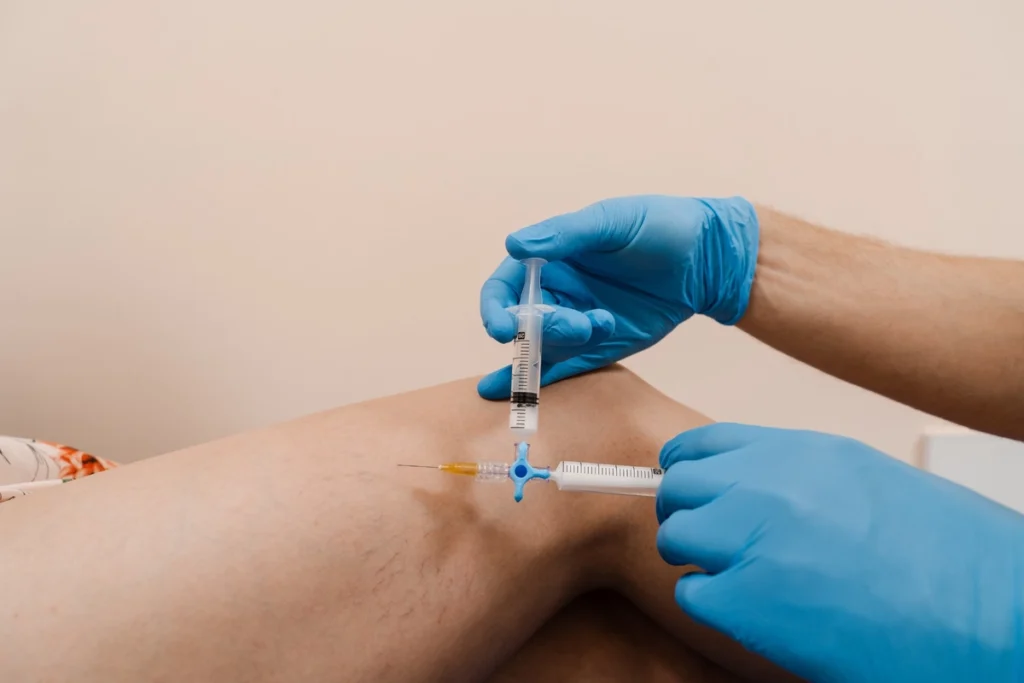 Patient Getting Sclerotherapy Injection at OC Cosmetic and Vein Center in Brea CA