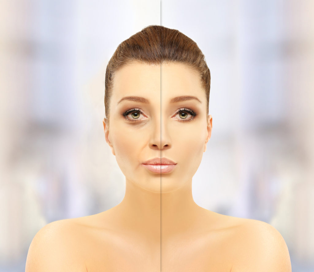 How Long Does Juvederm Take To Work? | OC Cosmetic & Vein Center