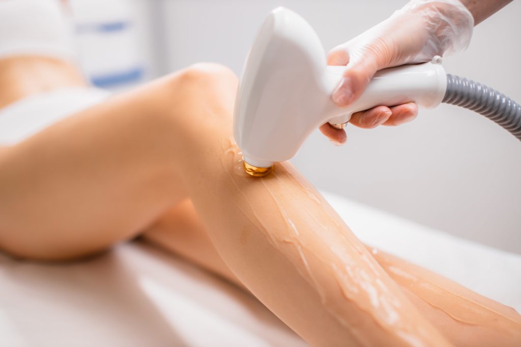 Laser Hair Removal-OC Cosmetic And Vein Center-2866 E Imperial Hwy, Brea, CA