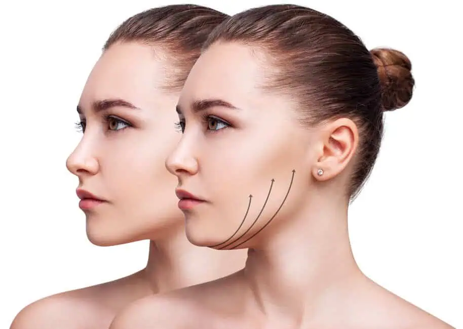 CoolSculpting Mini by OC COSMETIC AND VEIN CENTER in Brea, CA
