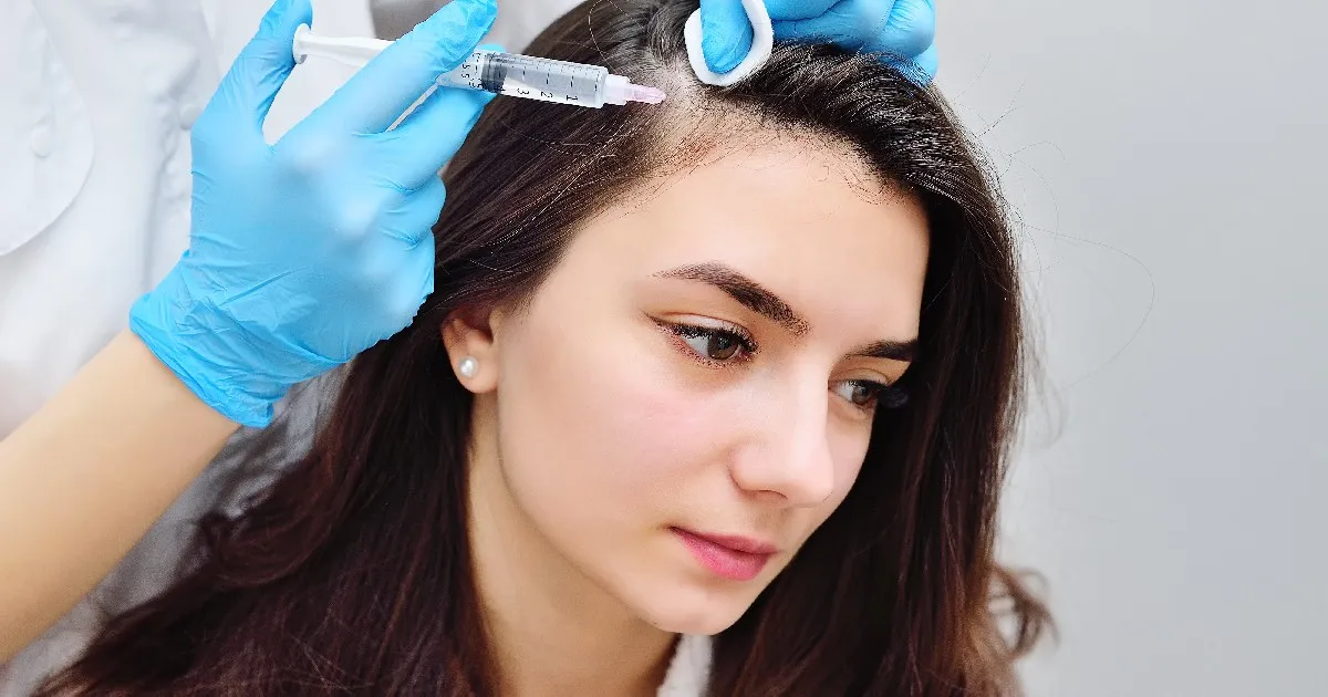 Women receiving PRP For Hair Restoration in Brea, CA